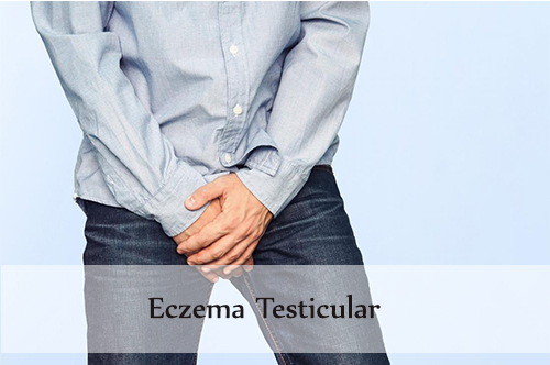 eczema testicular
