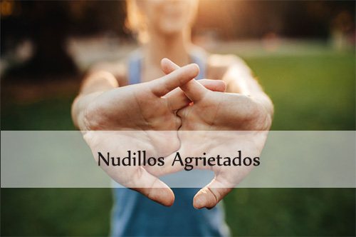 nudillos agrietados