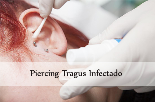 piercing tragus infectado
