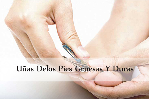uñas delos pies gruesas y duras