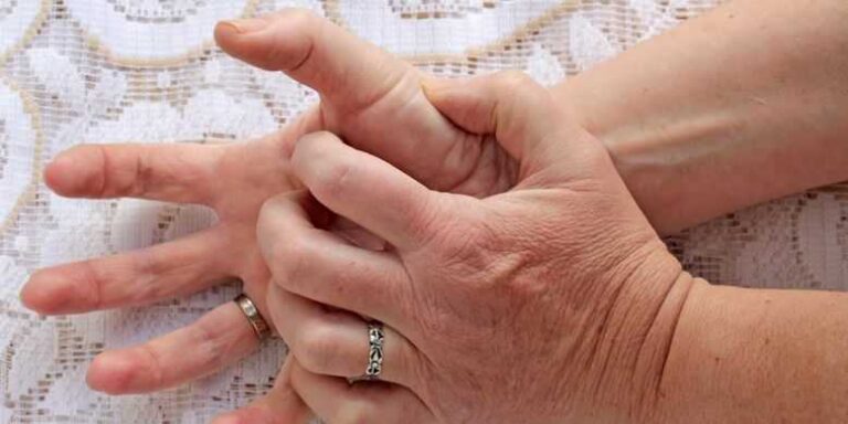 Picazón en la mano izquierda